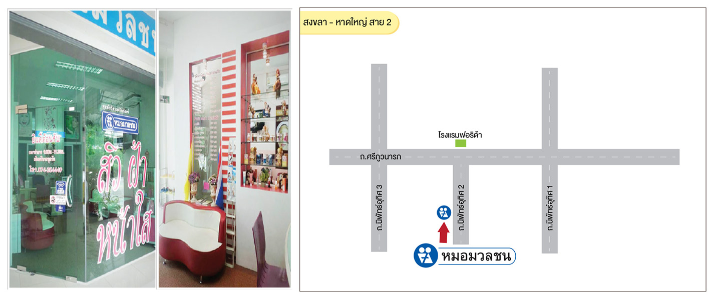 ศูนย์บริการผลิตภัณฑ์หมอมวลชน สงขลา - หาดใหญ่ สาย 2